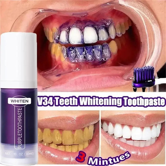 TRENDZ V34 Teeth Whitening Toothpaste